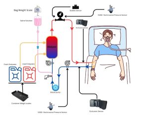Dialysis Image using SMD Sensors
